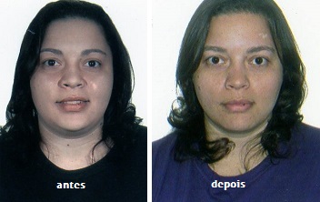 PAULA ANTES E DEPOIS