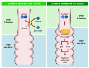 lactose-intolerance_med